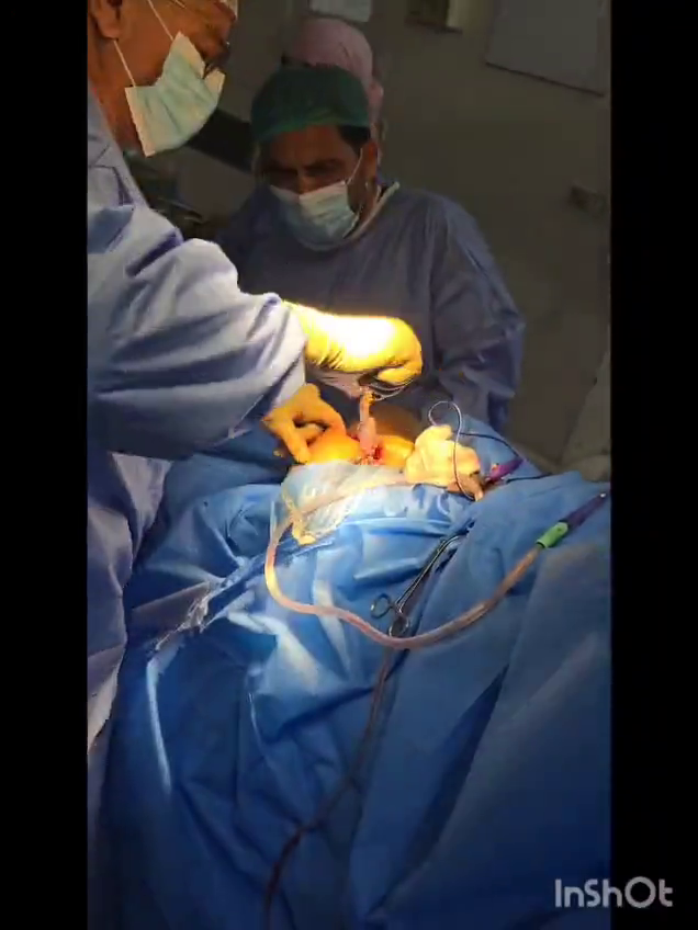 Revision Total Hip by Dr Muhammad Inam